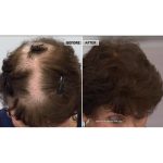TRUHAIR® Color & Lift Thickening Fibers - Light Blonde