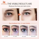 Dark Circles Eye Essence Anti-Wrinkle Diminishing Fine Lines Eliminating Edema Whitening Moisturizing Roll-on Massage Eye Care
