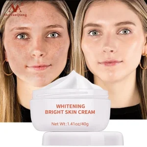 Moisturiser-Face-Whitening-Freckle-Cream-Remove-Acne-Spots-Melanin-Dark-Spots-Face-Lift-Firming-Face-Skin.jpg_ (4)