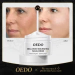 OEDO Anti-aging Face Cream Snail Face Cream Anti-wrinkle Lightening Wrinkles Whitening Moisturizing Face Nourishing Skin Care