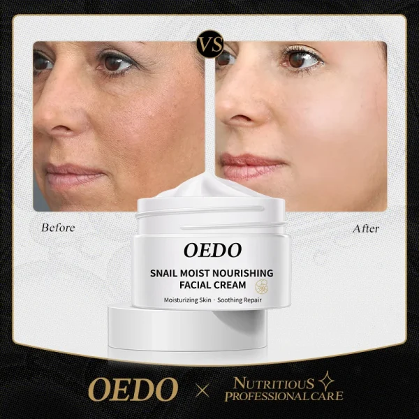 OEDO Anti-aging Face Cream Snail Face Cream Anti-wrinkle Lightening Wrinkles Whitening Moisturizing Face Nourishing Skin Care