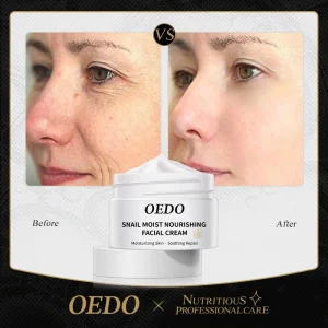 OEDO-Anti-aging-Face-Cream-Snail-Face-Cream-Anti-wrinkle-Lightening-Wrinkles-Whitening-Moisturizing-Face-Nourishing.jpg_ (3)
