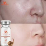 Pore Ampoule Snail100% Essence Liquid Whitening Spot Essence Shrink Pores Ampoule Anti-acne Regenerative Essence
