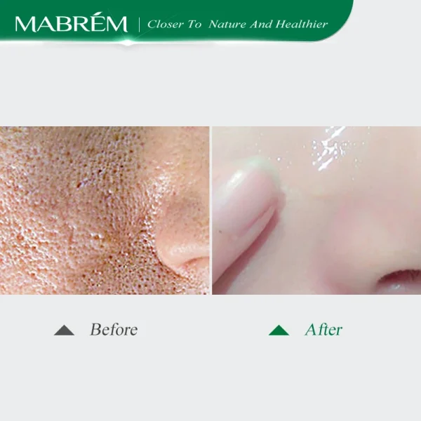 Pore ​​Serum Shrink Pores Clean Blackhead Anti-aging Lighten Fine Lines Long Lasting Moisturizing Whitening Nourishing Face Care